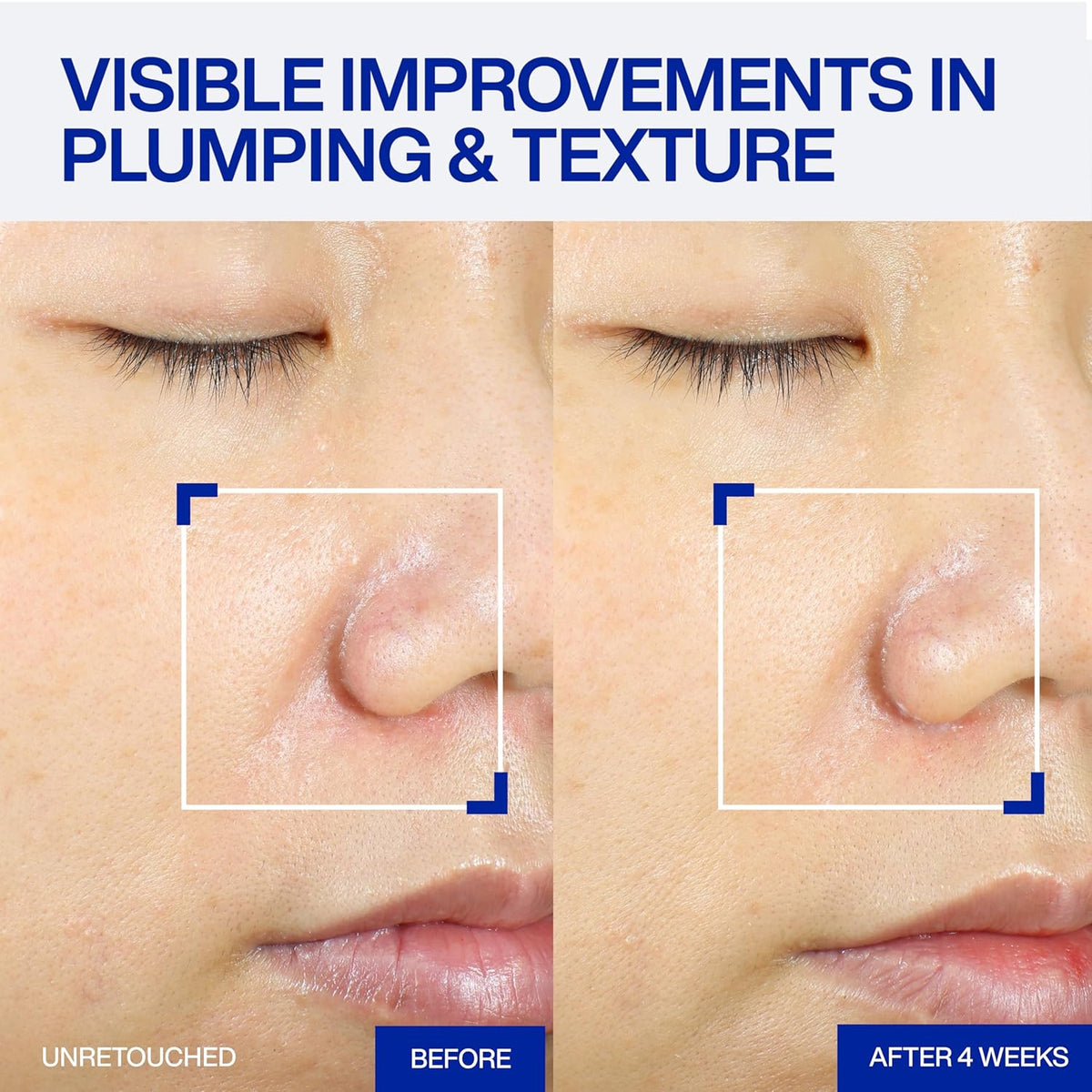 IOPE XMD Stem III Clinical Recovery Serum - Professional PDRN Treatment-Level Results - Visibly Firms, Plumps Volume, and Refines Pores - With Hyaluronic Acid - 1.01 fl. oz.